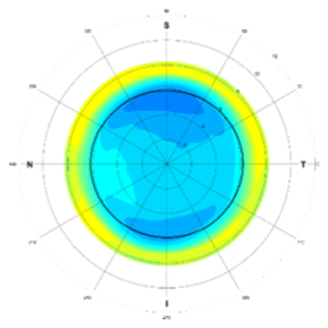 2D Lens Elevation