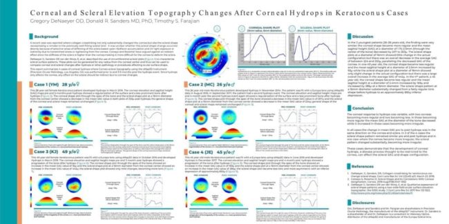 Corneal and Scleral Elevation Topography