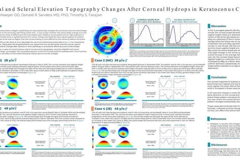 Corneal and Scleral Elevation Topography