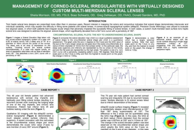 Management of corneo-scleral irregularities with virtually designed custom multi-meridian scleral lenses thumbnail