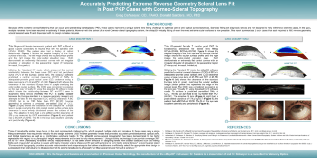 Extreme Reverse Geometry Fits in Post PKP Cases