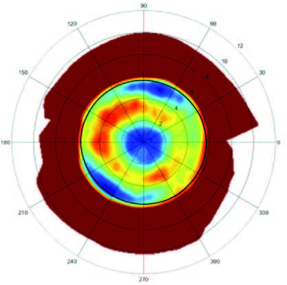 Reverse Geometry Lens Figure 1b