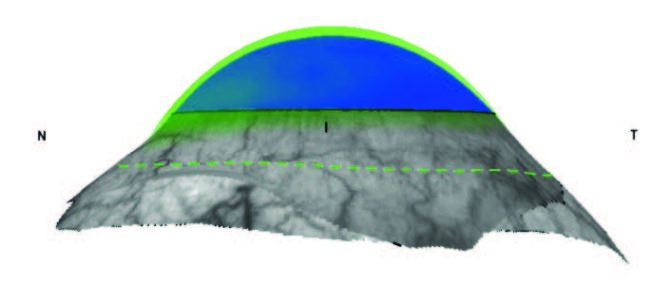 Reverse Geometry Lens Figure 2b