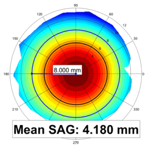 Sag Height