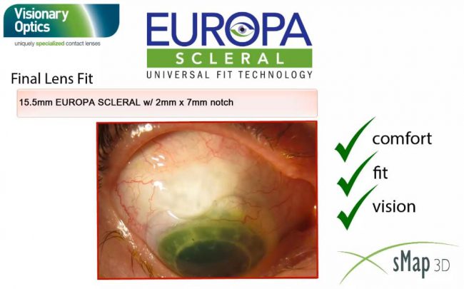 Video-Thumbnail-Notching-Capabilities