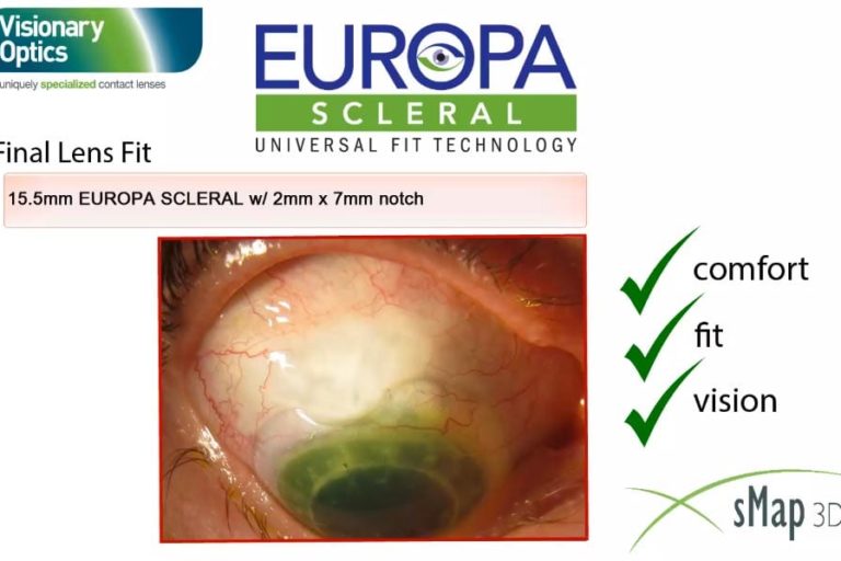 Video-Thumbnail-Notching-Capabilities