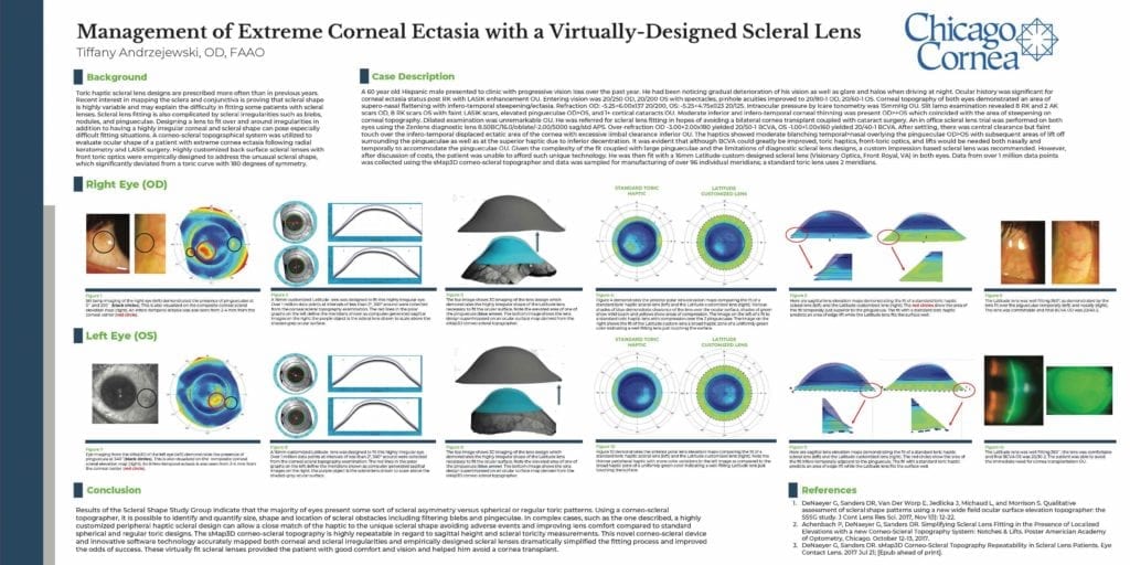 VirtuallyDesigned Scleral Lens Management Visionary Optics