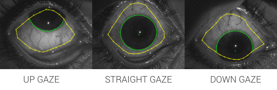 Surface Coverage sMap3D Eye Gazes
