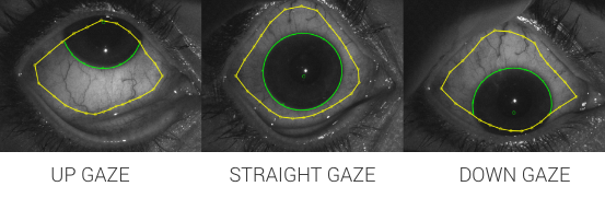 Surface Coverage sMap3D Eye Gazes