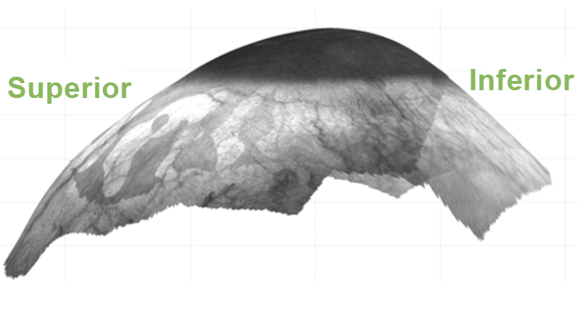 successful scleral lens fit figure 2