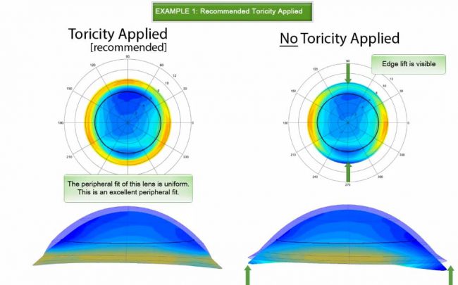 video-thumbnail-enhanced-scleral-toricity