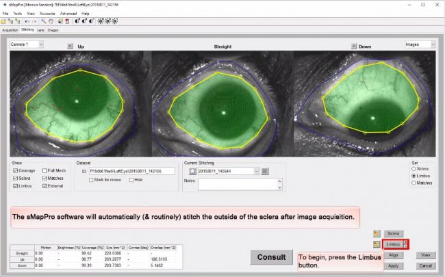 video-thumbnail-stitching-process