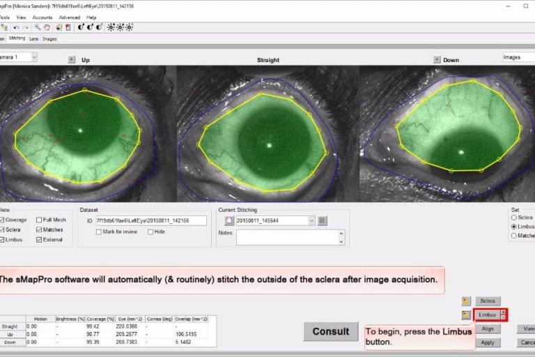 video-thumbnail-stitching-process