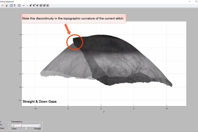 video-thumbnail-trim-up-down-limbus-tool