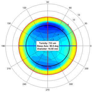 Scleral Toricity