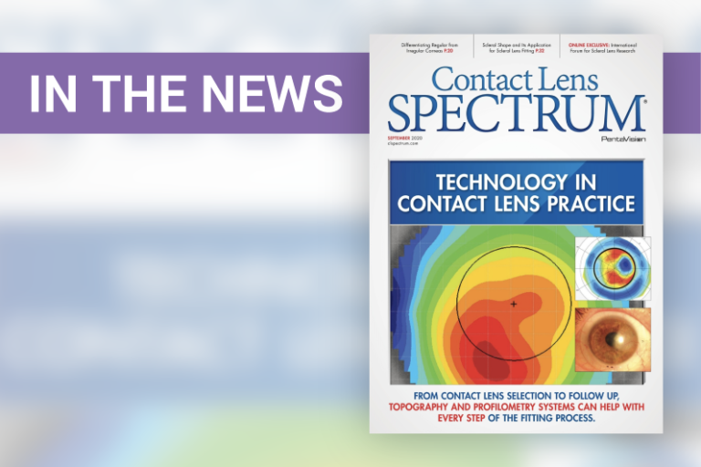 Technology in Contact Lens Practice: Scleral Shape and its Application for Scleral Lens Fitting