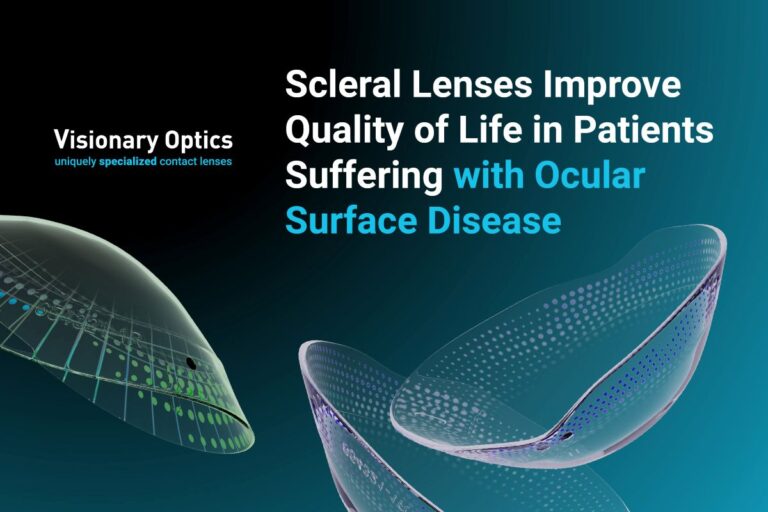 Scleral Lenses Improve Quality of Life in Patients Suffering with Ocular Surface Disease