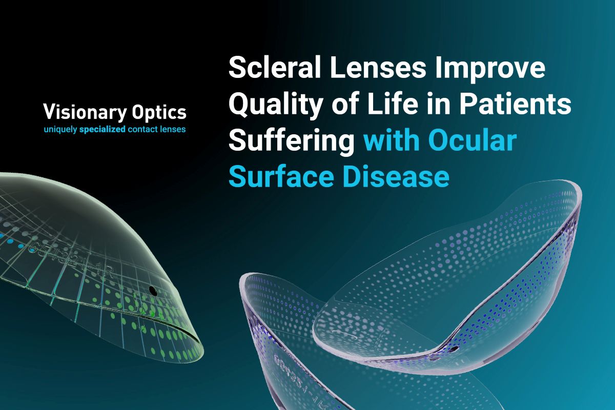 Scleral Lenses Improve Quality of Life in Patients Suffering with Ocular Surface Disease